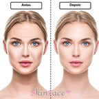 SkinFace™ - Adesivos de Silicone Rejuvenescedor Anti Rugas