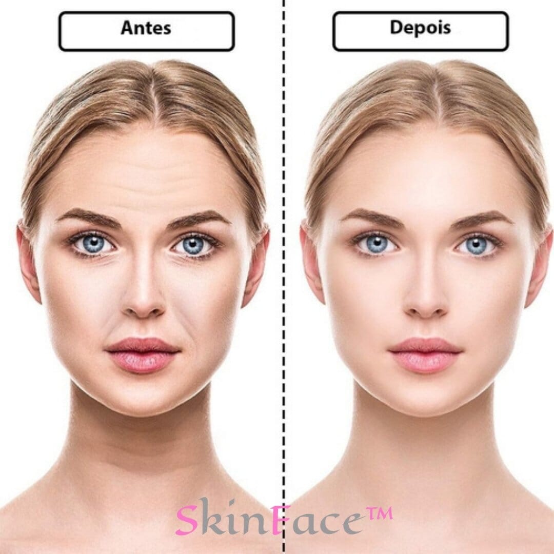 SkinFace™ - Adesivos de Silicone Rejuvenescedor Anti Rugas