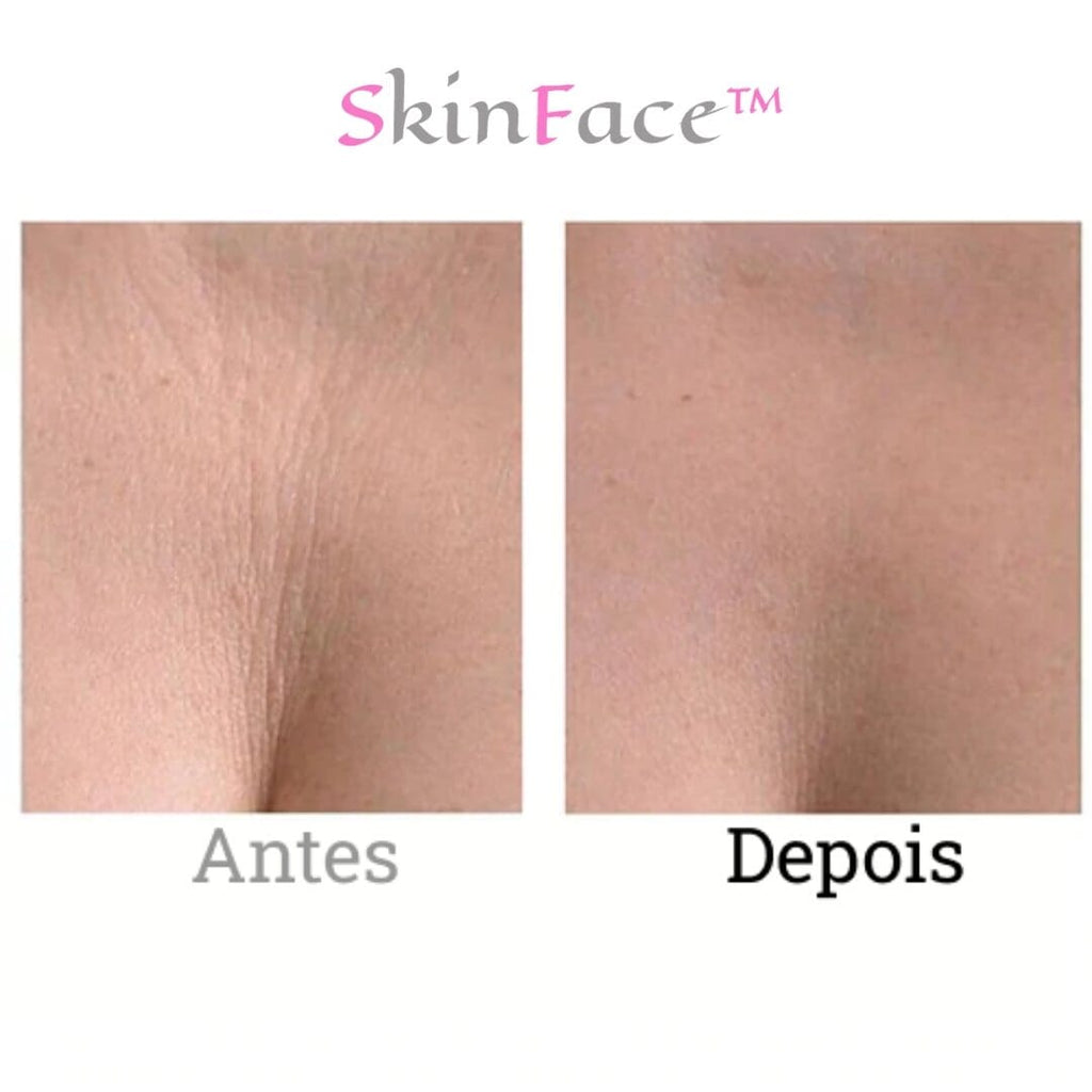 SkinFace™ - Adesivos de Silicone Rejuvenescedor Anti Rugas